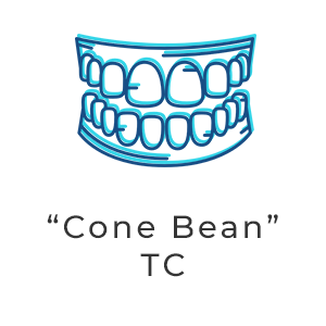 cone bean1